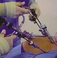 Bariatric Surgery Weight Loss