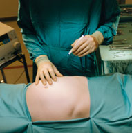 Weight Loss Surgery Clinic